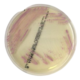 CHROMagar Staphylococous aureus