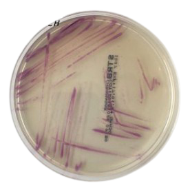 CHROMagar Strep B