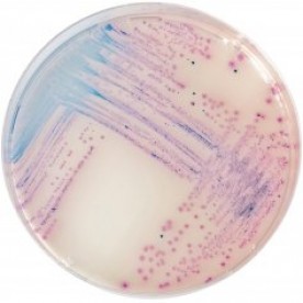 CHROMagar Salmonella