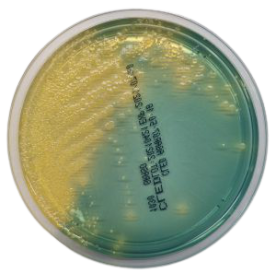 CLED Agar (Cystine Lactose Electrolyte Deficient Agar)