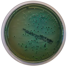 Hektoen Enteric Agar