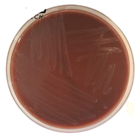 Chocolate Agar with Poly Vitex