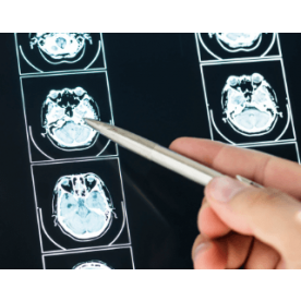 External quality control Tumor Markers