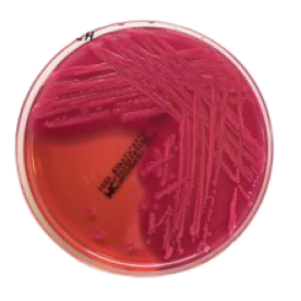 MacConkey Agar with crystal violet