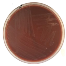 Interlab, Graso biotech, 1080